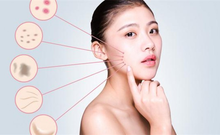 右脸长痘痘是如何产生的，去痘痘最好的方法！独生美告诉你祛痘美容护肤小常识！