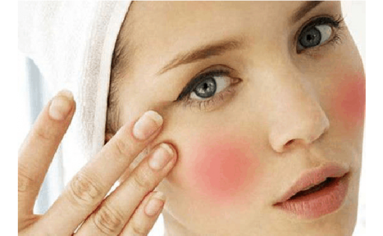 敏感肌肤适合的护肤品 敏感肌肤用什么护肤品比较好？