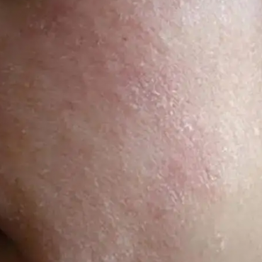 【独生美】618好物就在视频号 皮肤换季敏感拯救夏季干皮 懒人专用护肤品