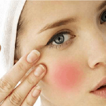 敏感肌肤适合的护肤品 敏感肌肤用什么护肤品比较好？